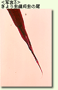 ぎょう虫ピン状の尾
